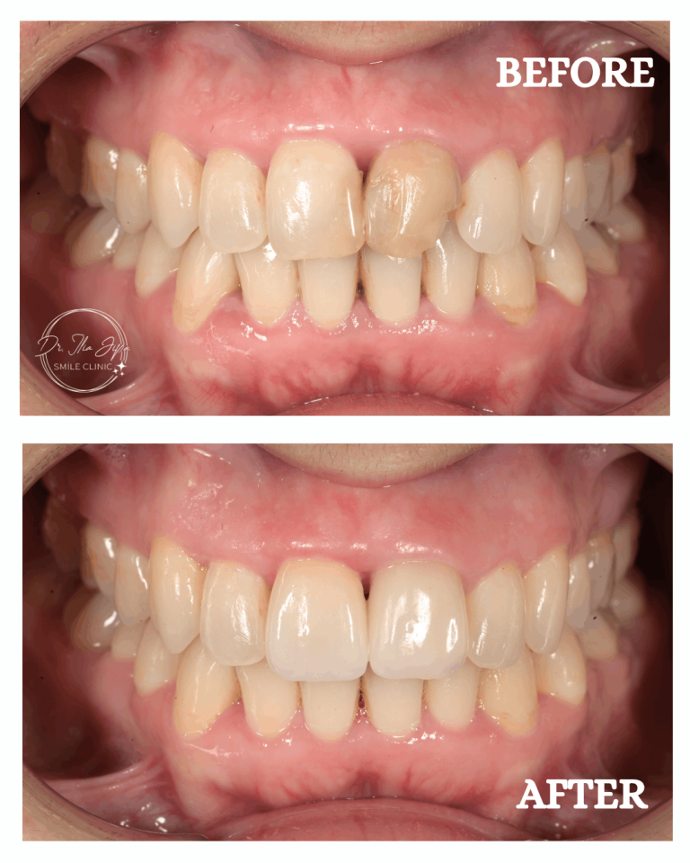 Caz 1: Povestea Alexandrei www.smilebydrilia.ro 2651