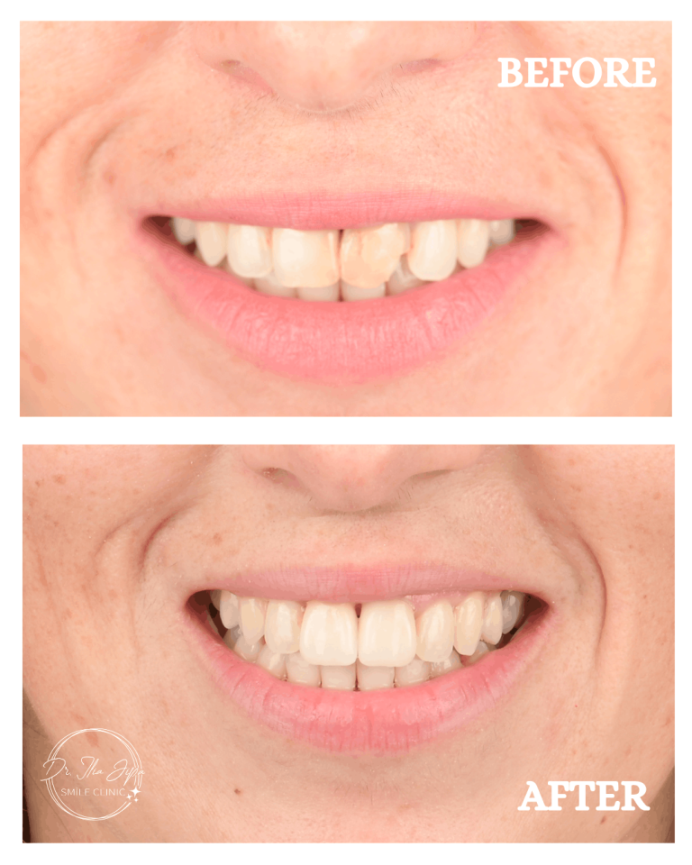 Caz 1: Povestea Alexandrei www.smilebydrilia.ro 2650