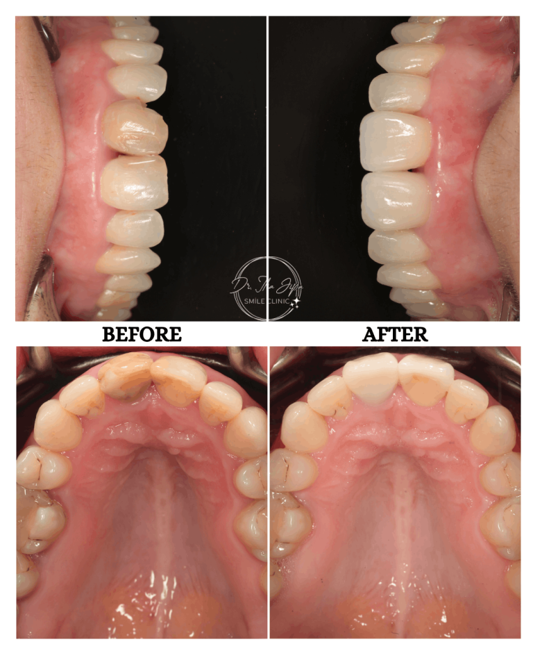 Caz 1: Povestea Alexandrei www.smilebydrilia.ro 2647