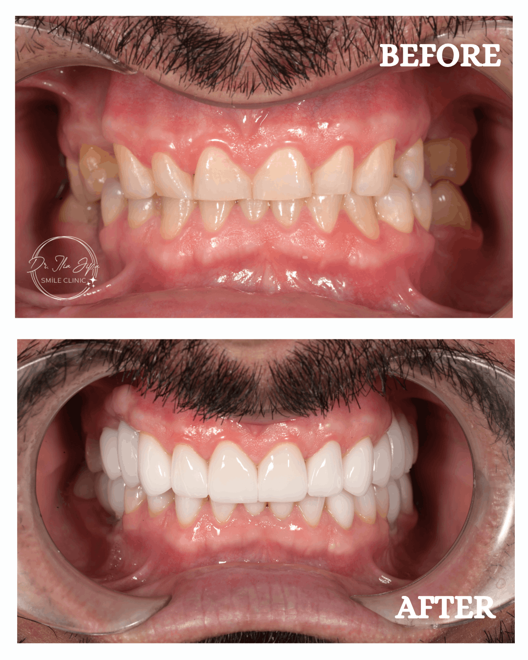 Caz 3: Povestea lui Nicușor www.smilebydrilia.ro 2677