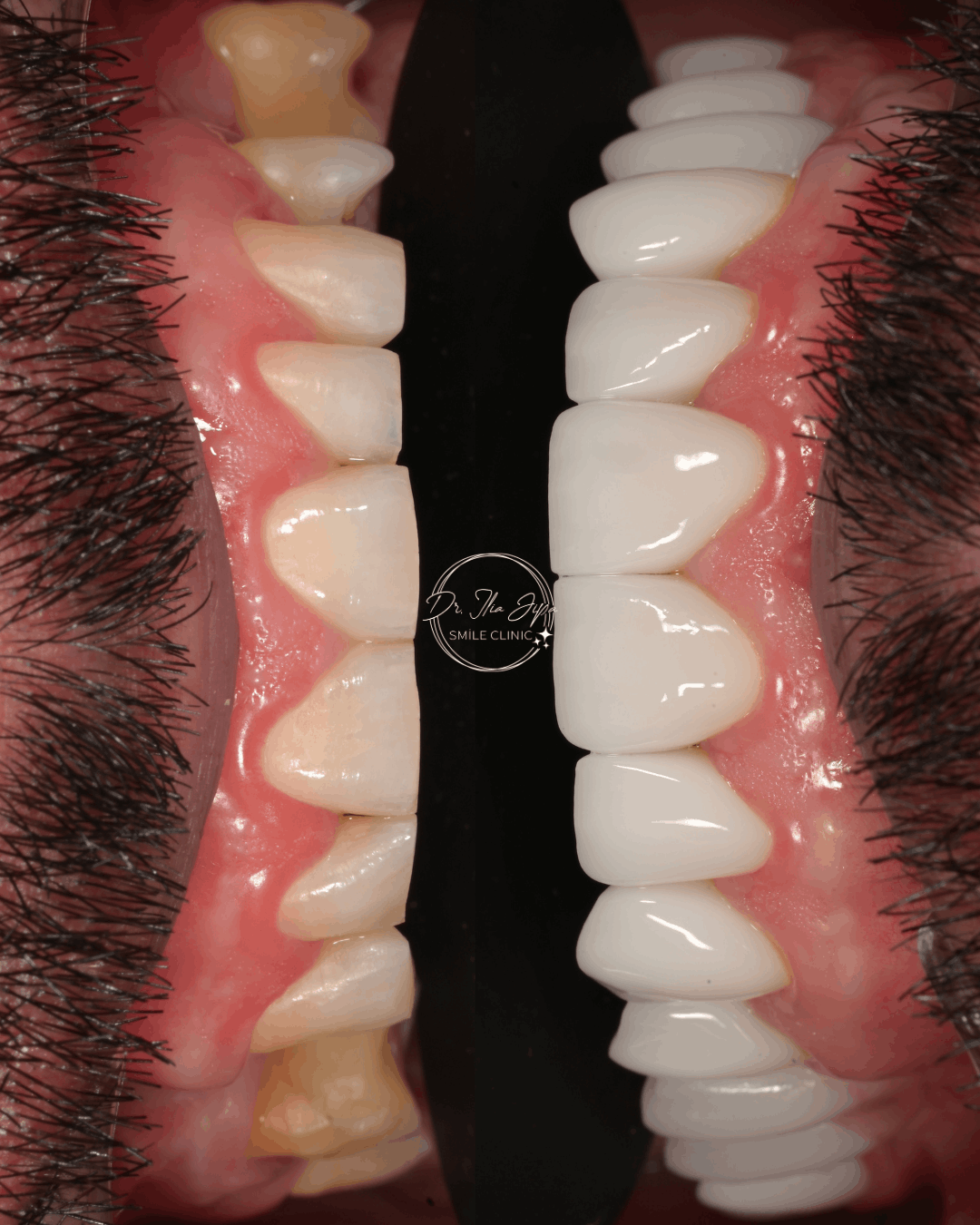 Caz 3: Povestea lui Nicușor www.smilebydrilia.ro 2681