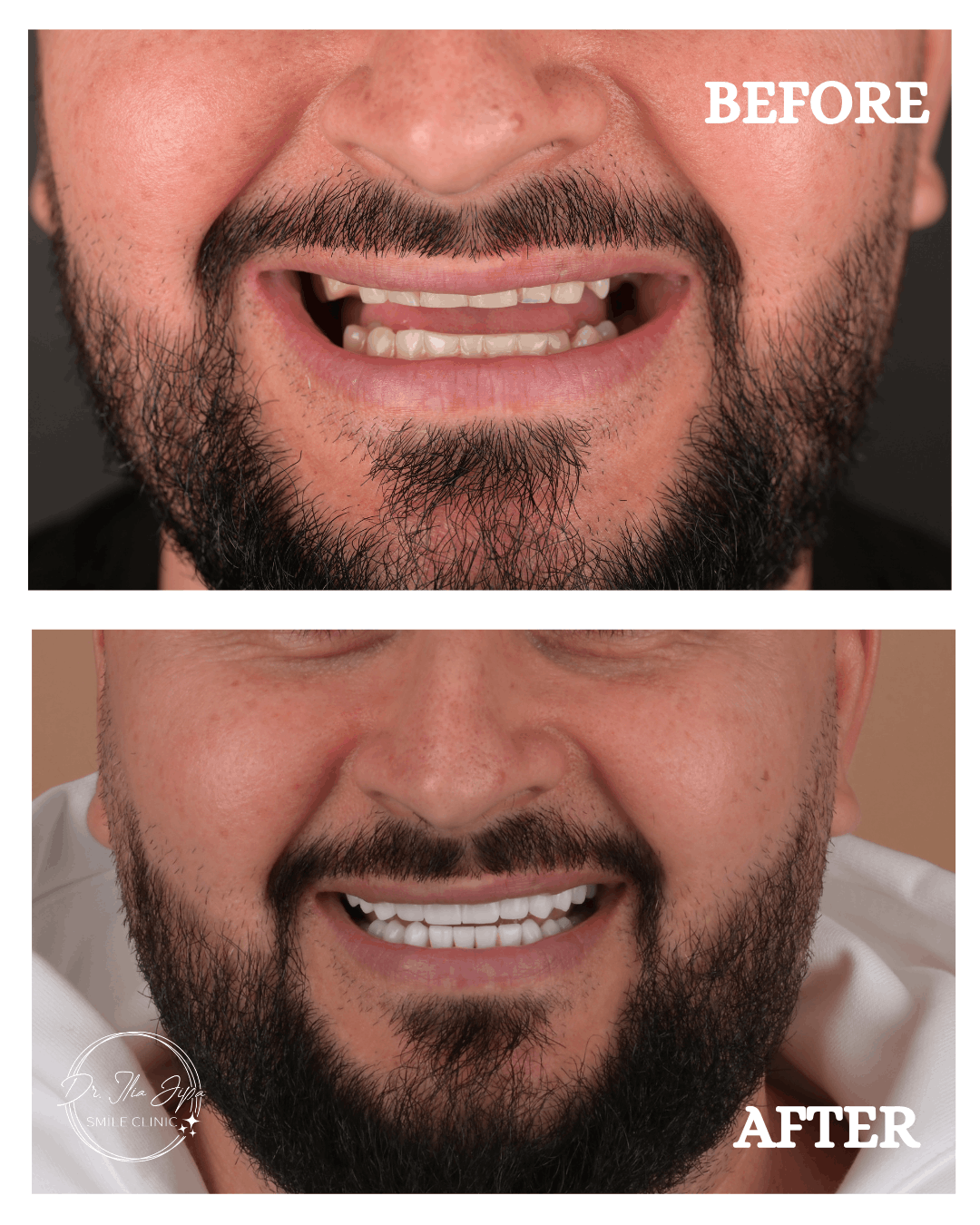 Caz 3: Povestea lui Nicușor www.smilebydrilia.ro 2678