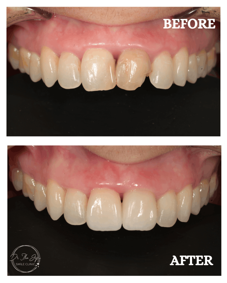 Caz 1: Povestea Alexandrei www.smilebydrilia.ro 2648