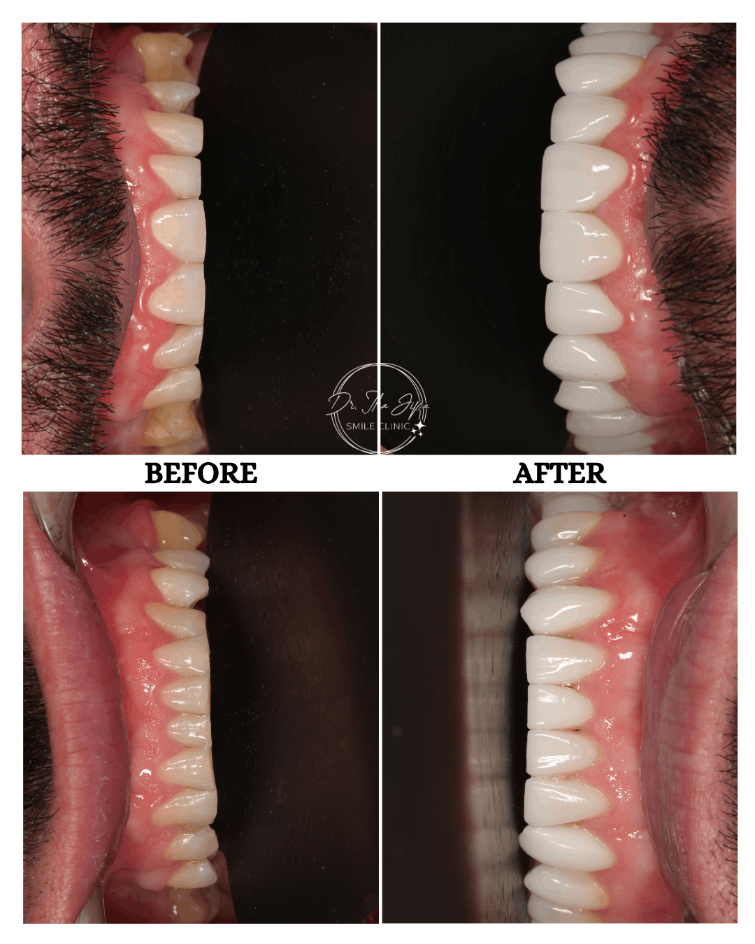 Caz 3: Povestea lui Nicușor www.smilebydrilia.ro 2679