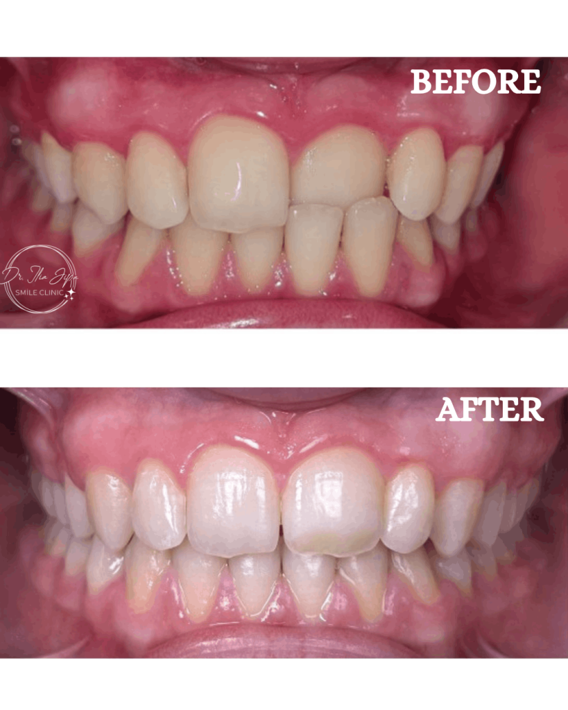 Ortodonție Modernă & Estetică Funcțională www.smilebydrilia.ro 2545