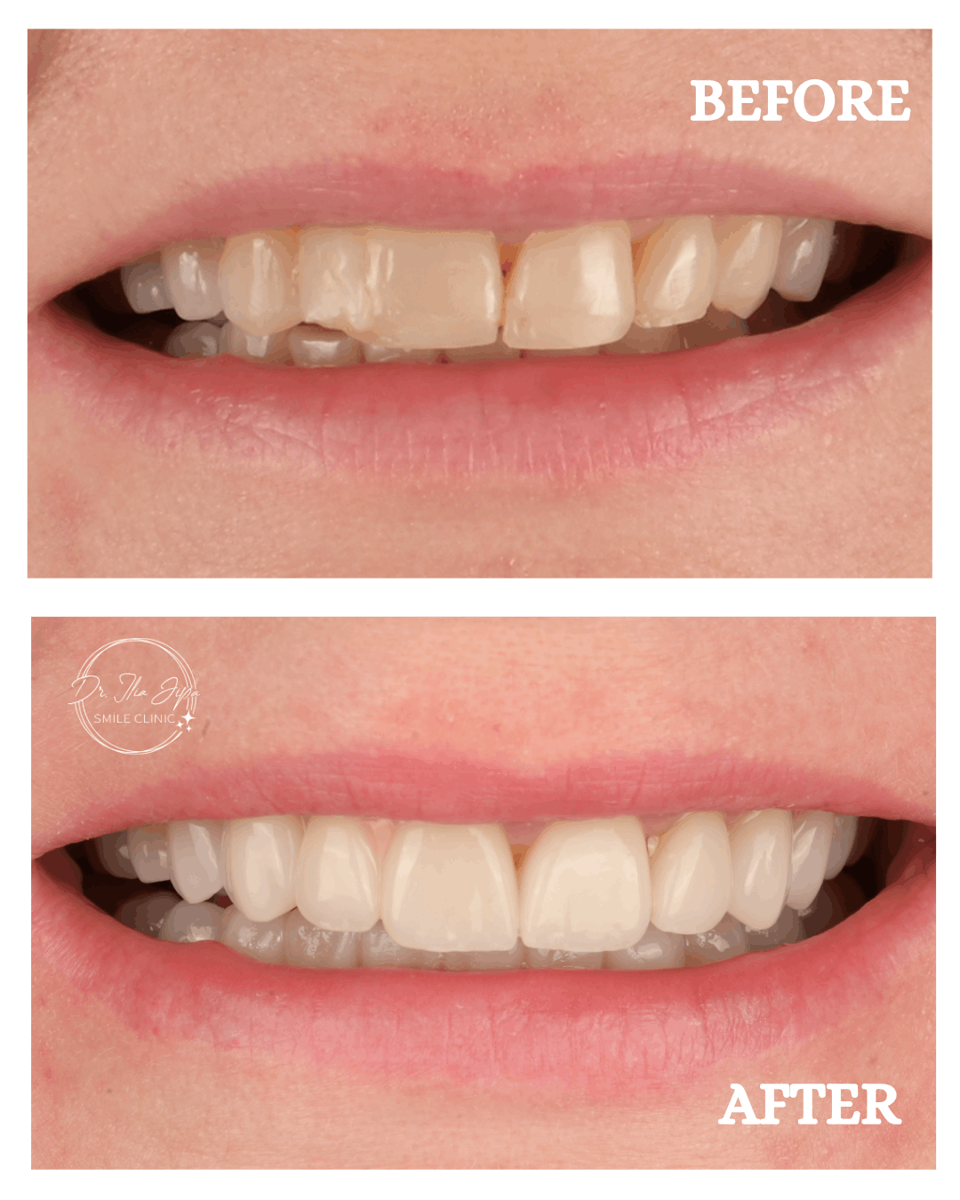 Caz 4: Povestea Aureliei www.smilebydrilia.ro 2688