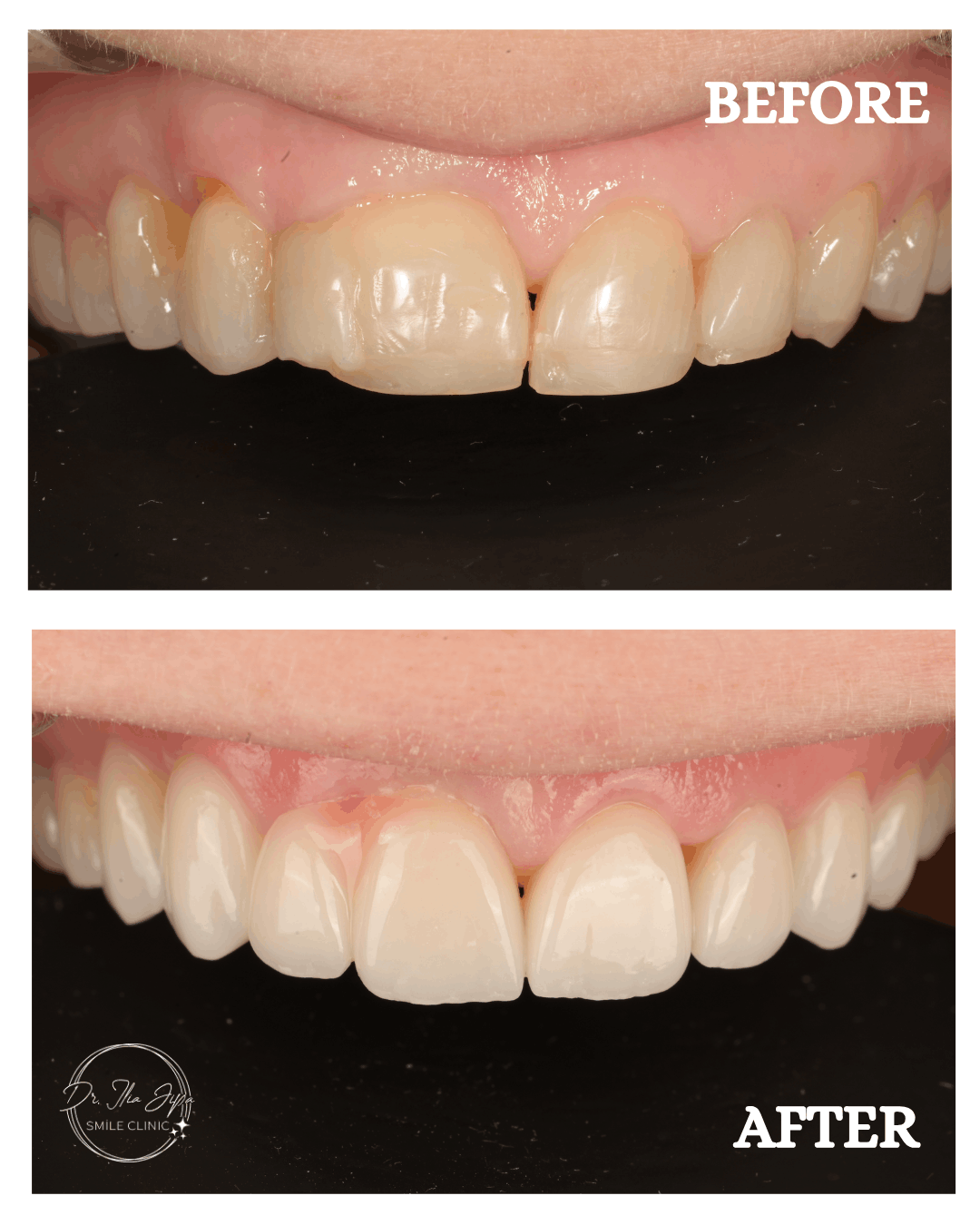 Caz 4: Povestea Aureliei www.smilebydrilia.ro 2690