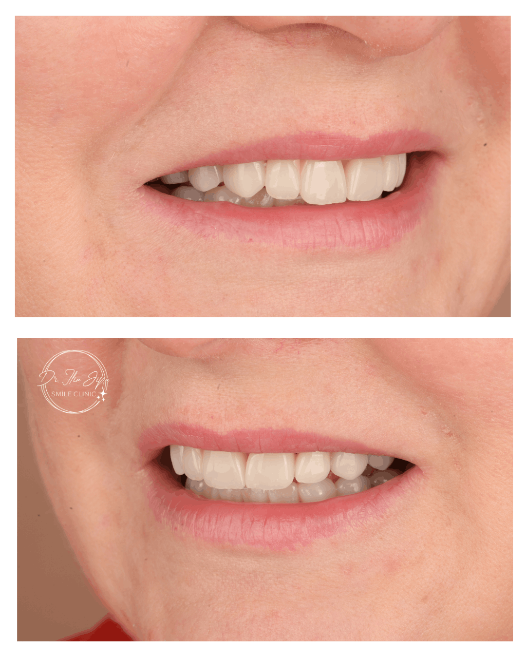 Caz 4: Povestea Aureliei www.smilebydrilia.ro 2689