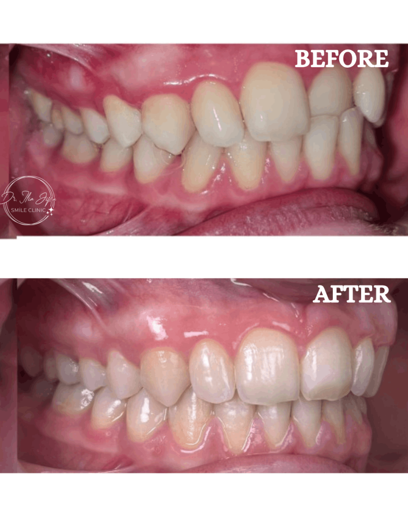 Ortodonție Modernă & Estetică Funcțională www.smilebydrilia.ro 2544