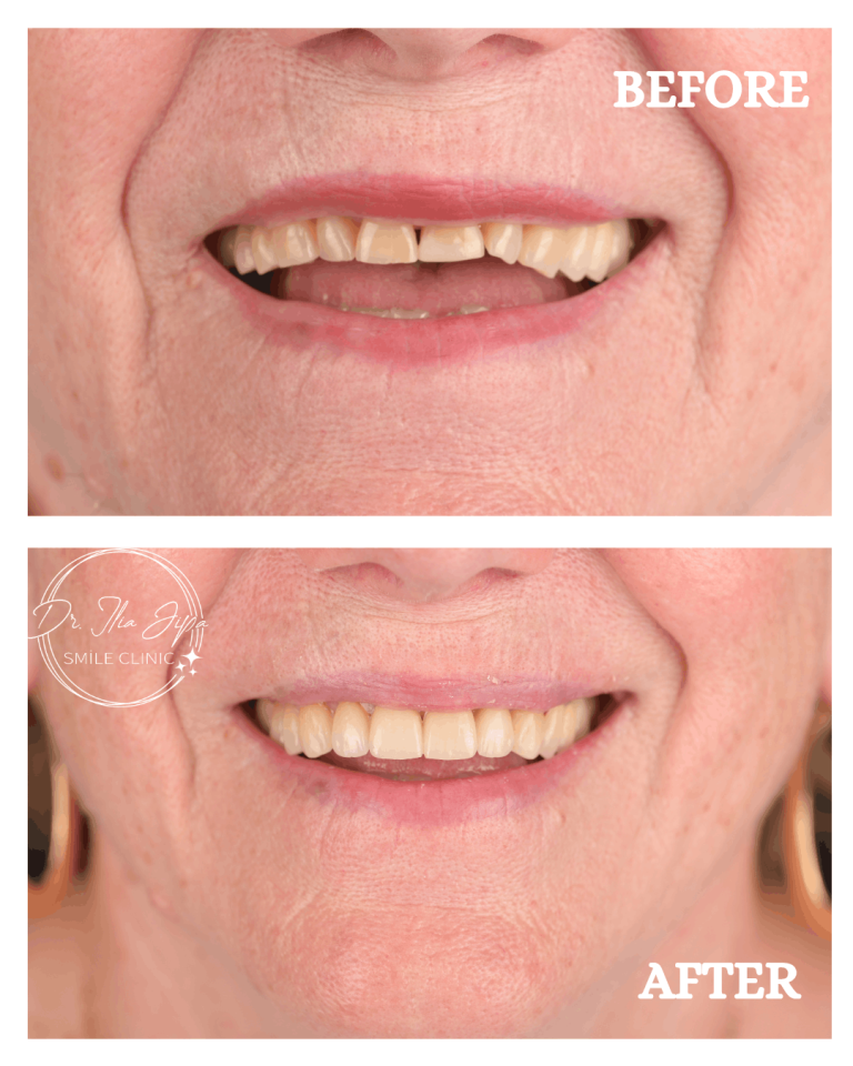 Caz 2: Povestea Irinei www.smilebydrilia.ro 2665