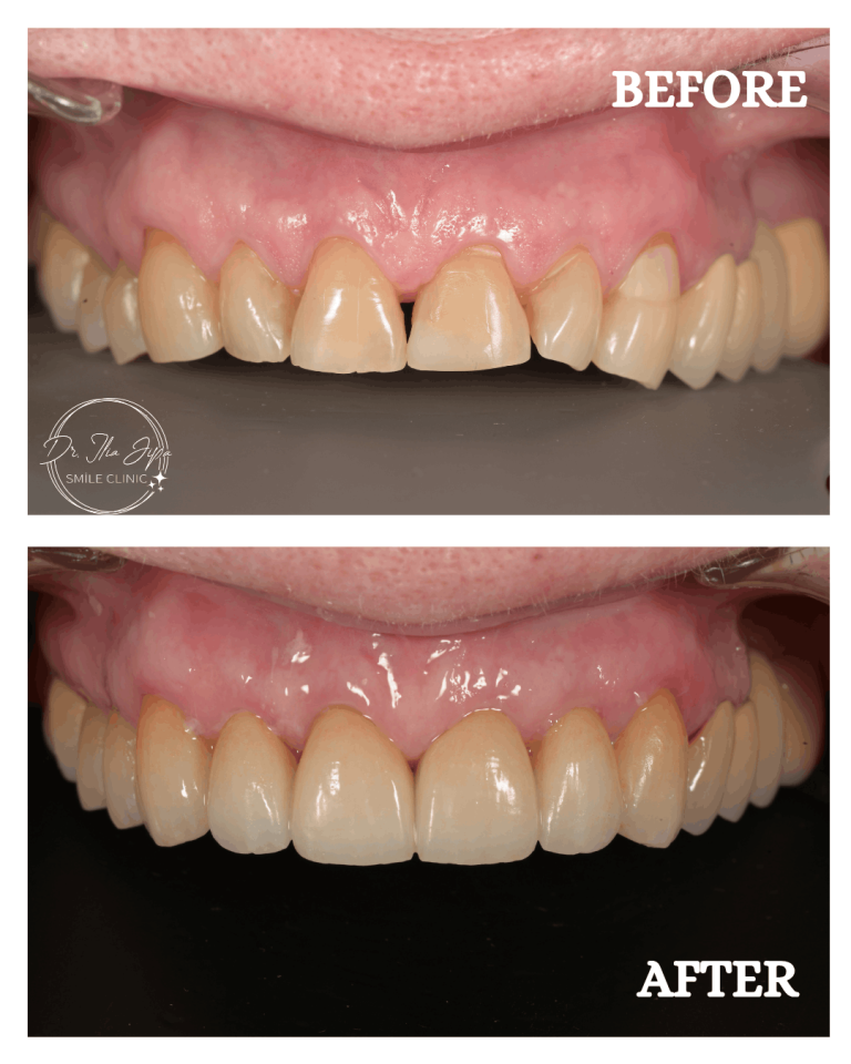 Caz 2: Povestea Irinei www.smilebydrilia.ro 2662