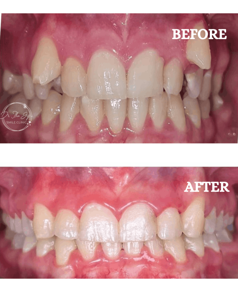 Ortodonție Modernă & Estetică Funcțională www.smilebydrilia.ro 2549