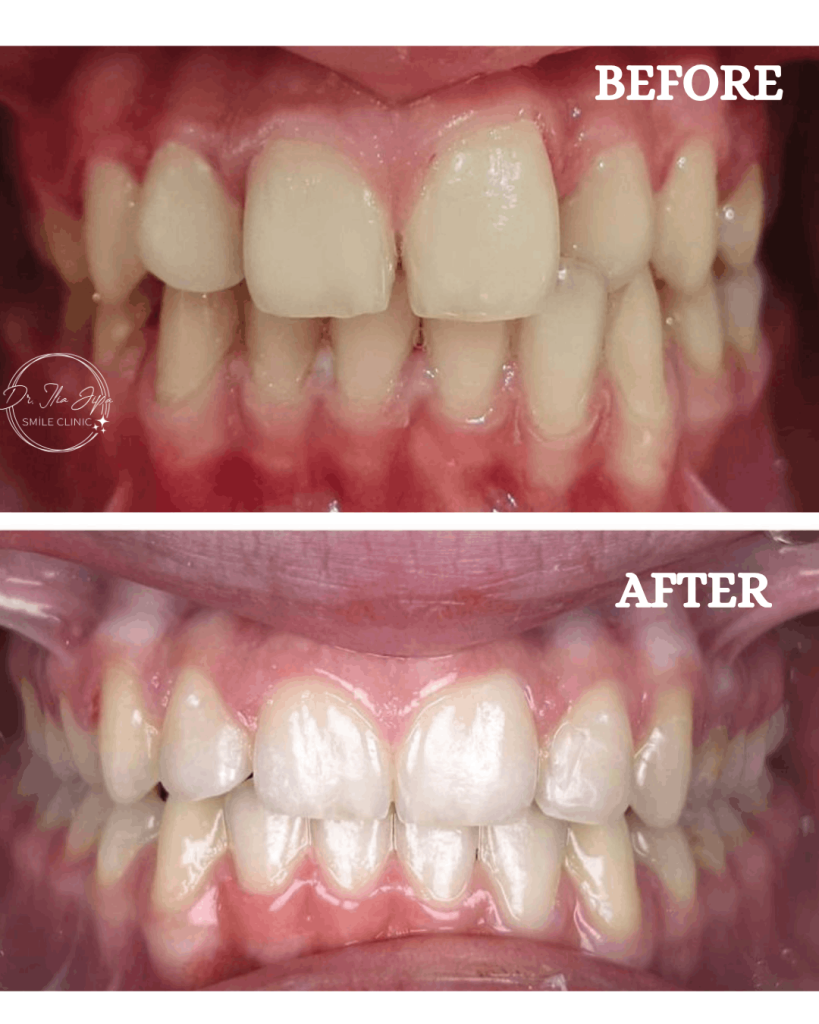 Ortodonție Modernă & Estetică Funcțională www.smilebydrilia.ro 2547