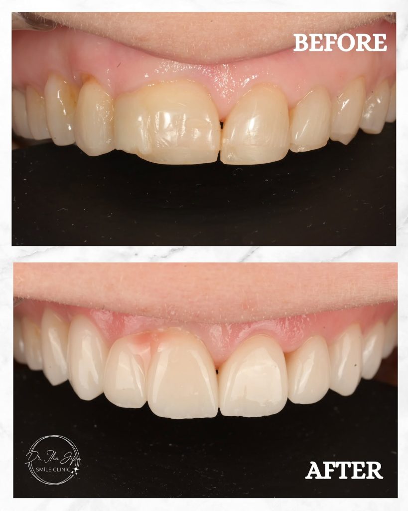 Estetică Dentară www.smilebydrilia.ro 2355