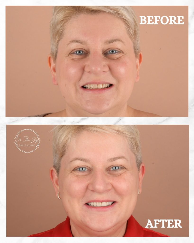 Estetică Dentară www.smilebydrilia.ro 2356