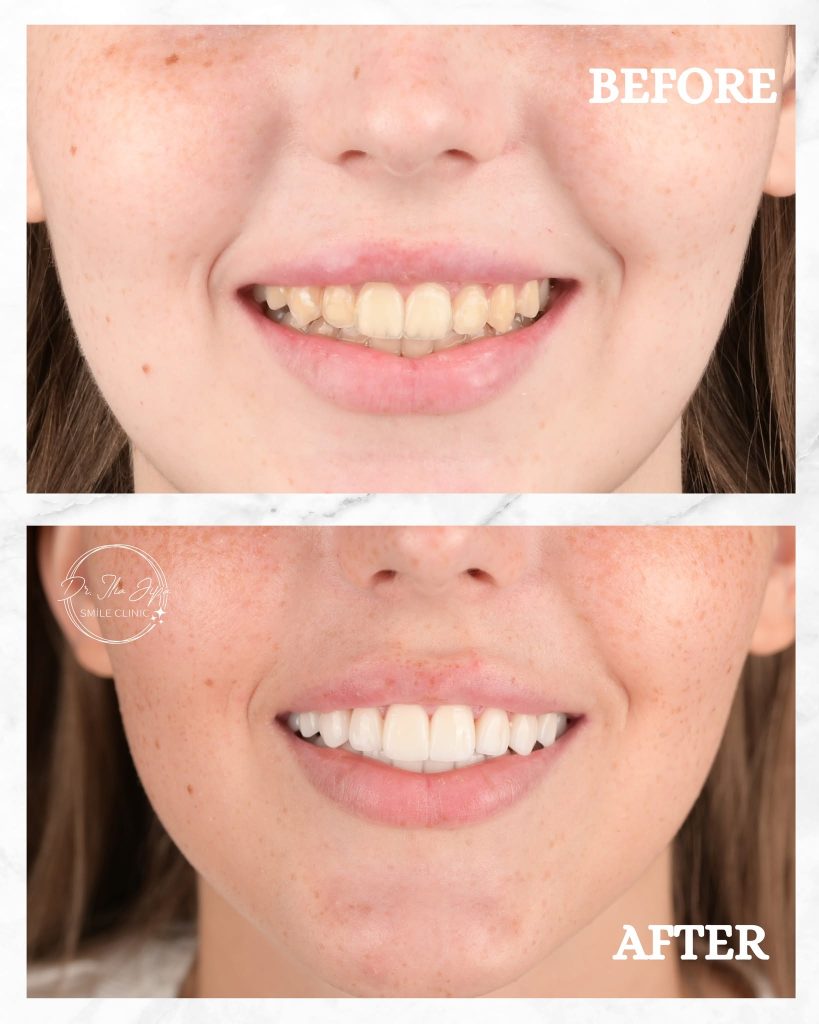 Estetică Dentară www.smilebydrilia.ro 2357