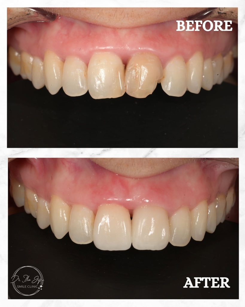 Estetică Dentară www.smilebydrilia.ro 2359