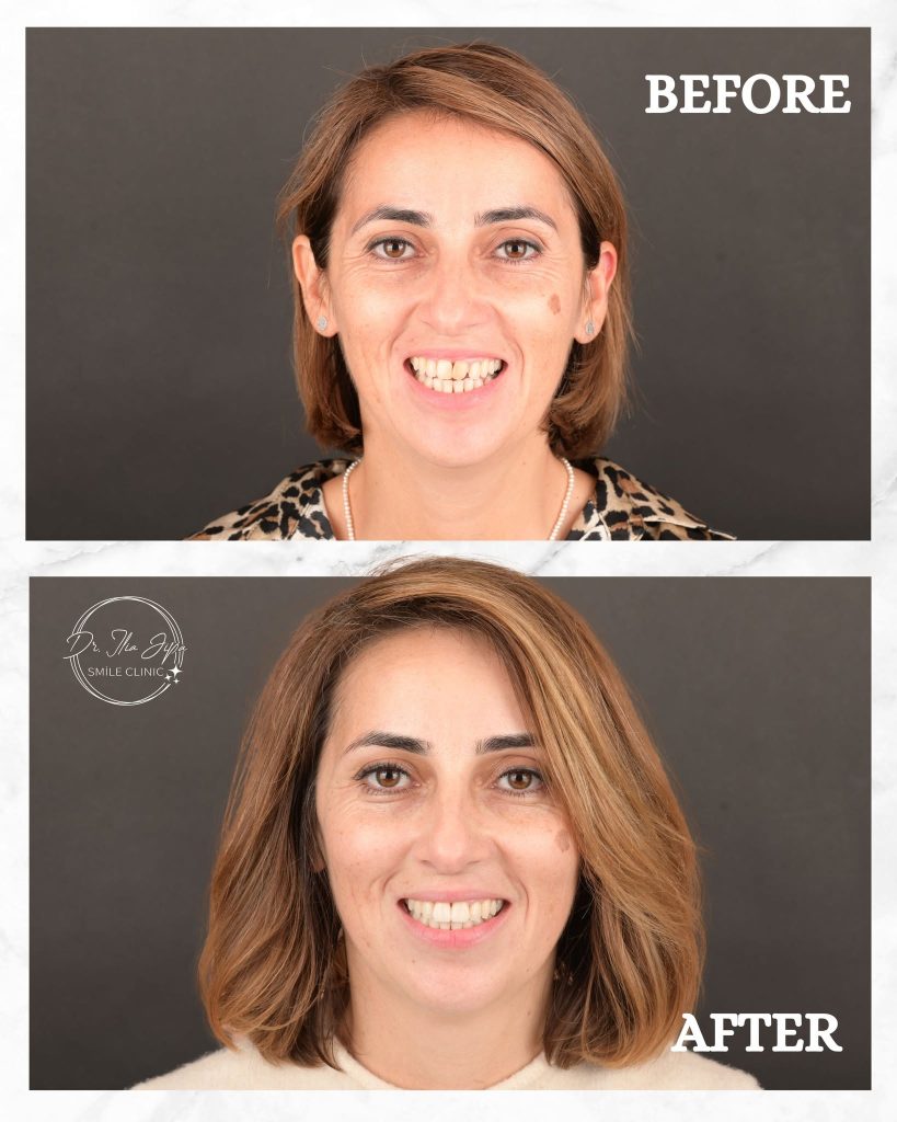 Estetică Dentară www.smilebydrilia.ro 2360