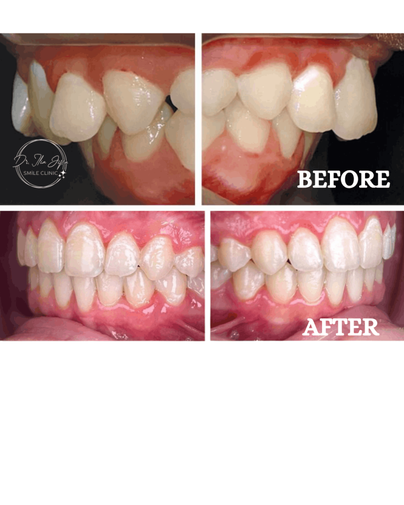 Ortodonție Modernă & Estetică Funcțională www.smilebydrilia.ro 2550