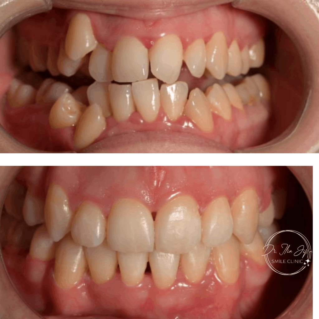 Ortodonție Modernă & Estetică Funcțională www.smilebydrilia.ro 2546
