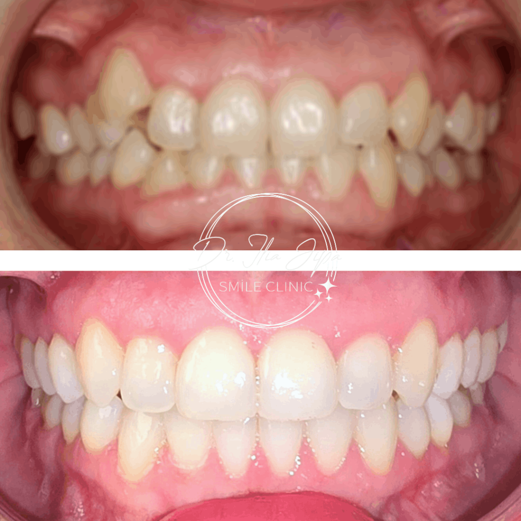 Ortodonție Modernă & Estetică Funcțională www.smilebydrilia.ro 2548