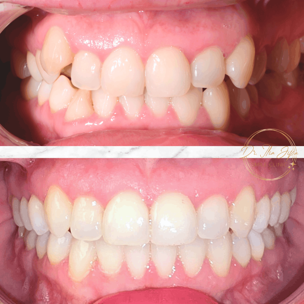 Ortodonție Modernă & Estetică Funcțională www.smilebydrilia.ro 2551