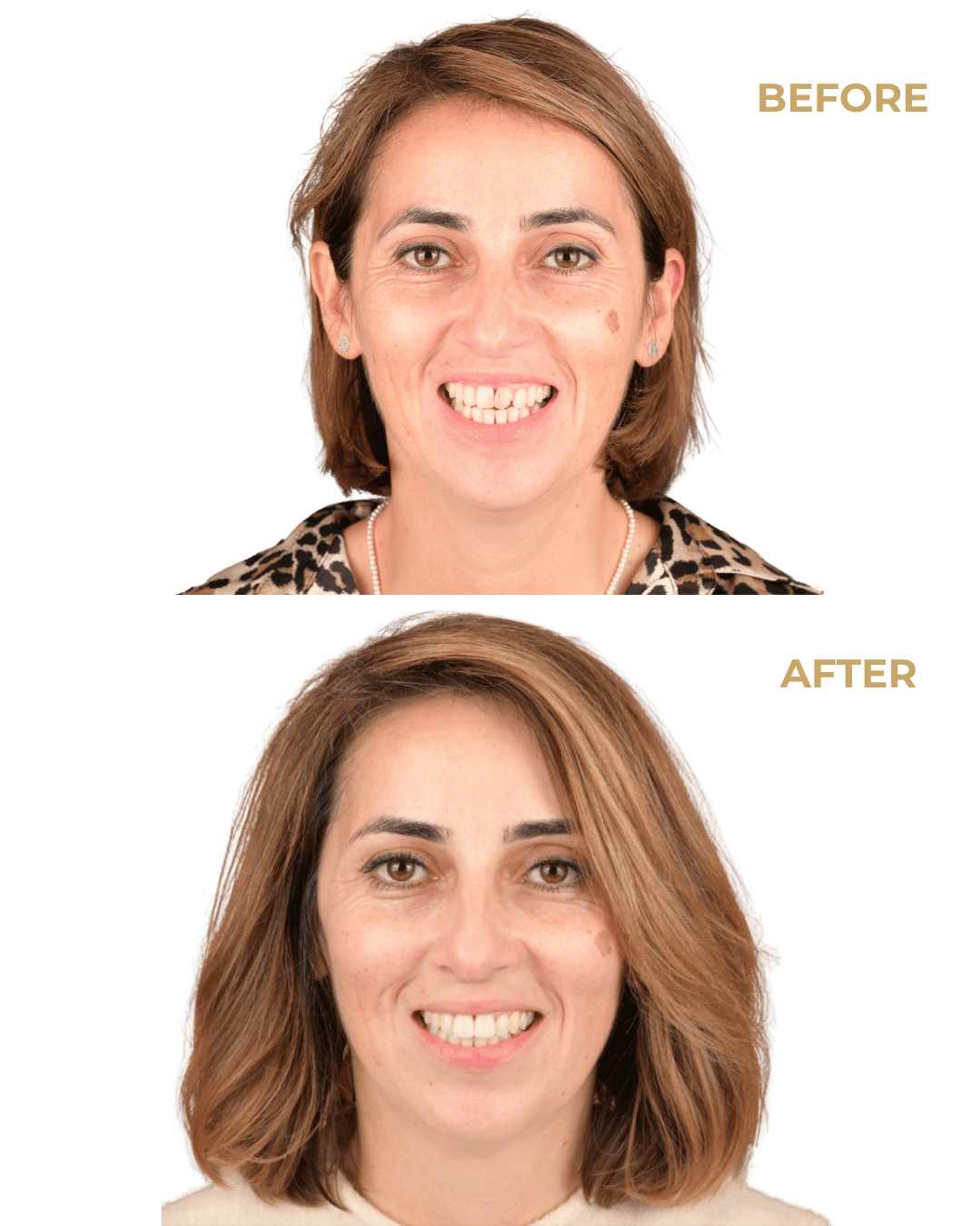 Caz 1: Povestea Alexandrei www.smilebydrilia.ro 3090