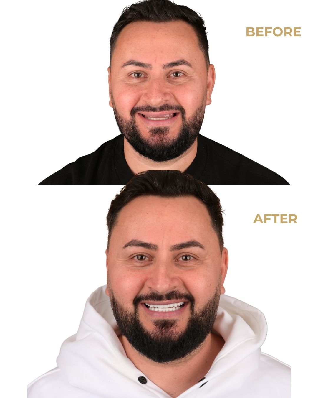 Caz 3: Povestea lui Nicușor www.smilebydrilia.ro 3150