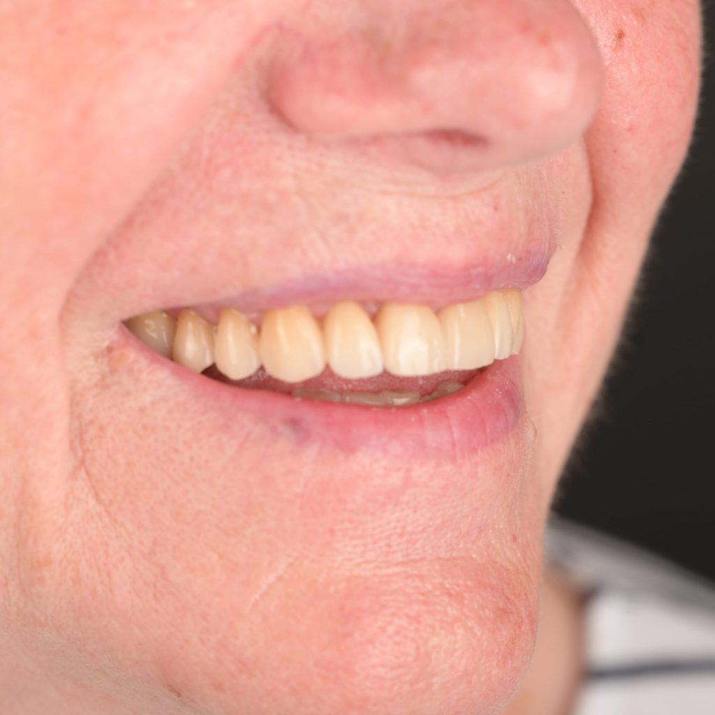Estetică Dentară www.smilebydrilia.ro 2582