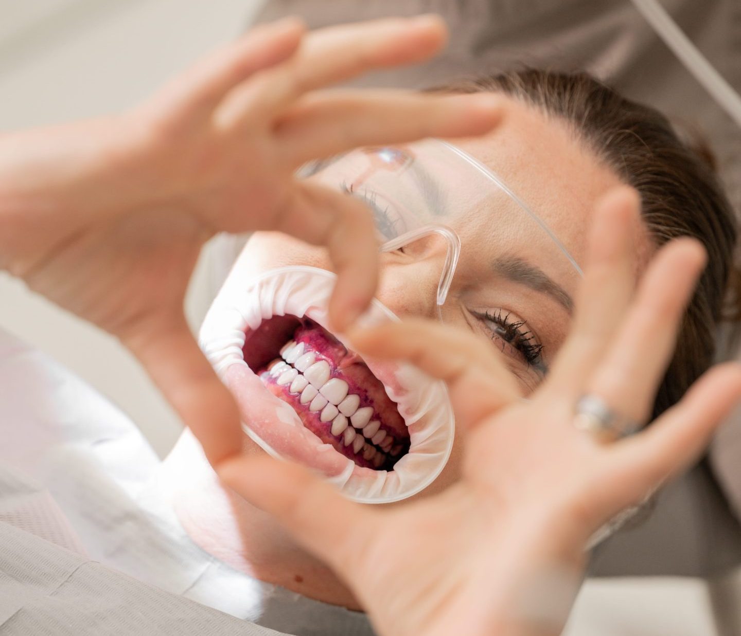 Stomatologie Minim-Invazivă & Laser www.smilebydrilia.ro 2571
