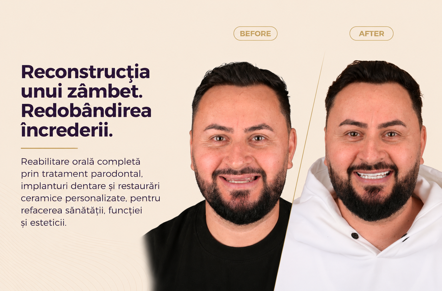 Caz 3: Povestea lui Nicușor www.smilebydrilia.ro 3155