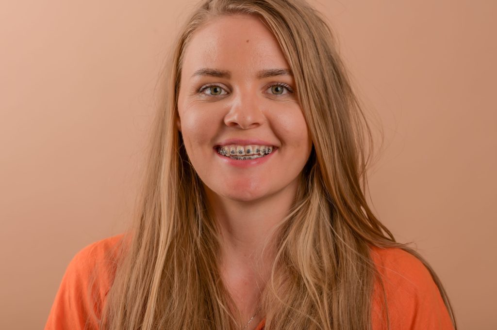 Ortodonție Modernă & Estetică Funcțională www.smilebydrilia.ro 2560