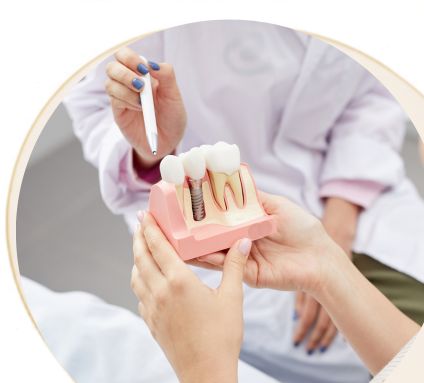  Implantologie & Dinți Ficși www.smilebydrilia.ro 2372