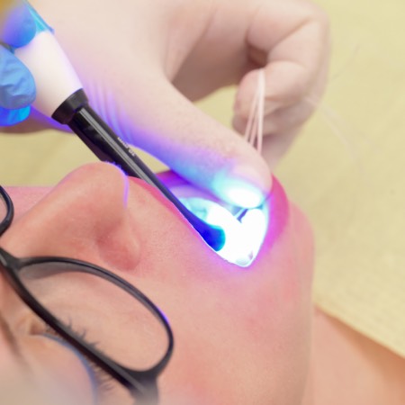 Stomatologie Minim-Invazivă & Laser www.smilebydrilia.ro 2334
