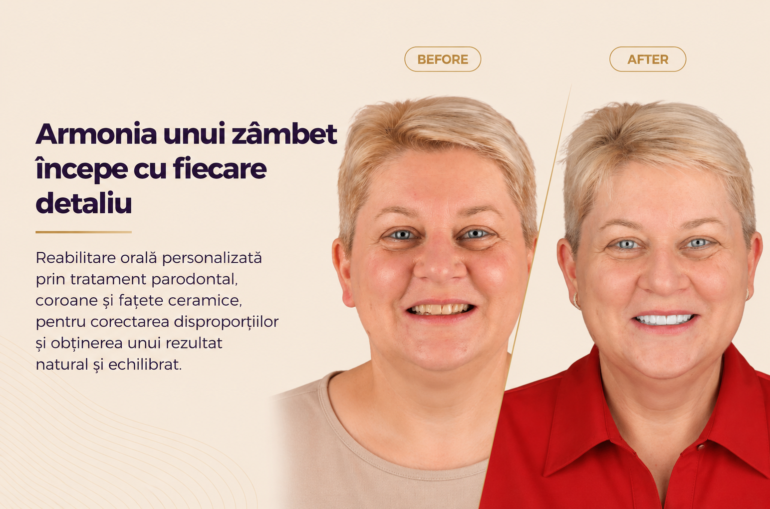 Caz 4: Povestea Aureliei www.smilebydrilia.ro 3171
