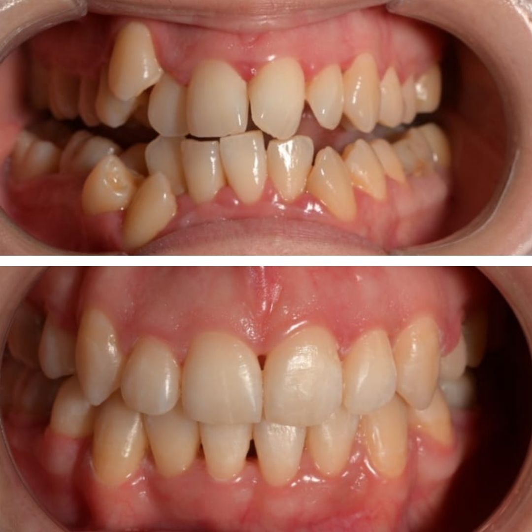 Caz 5: Povestea Dianei www.smilebydrilia.ro 3579