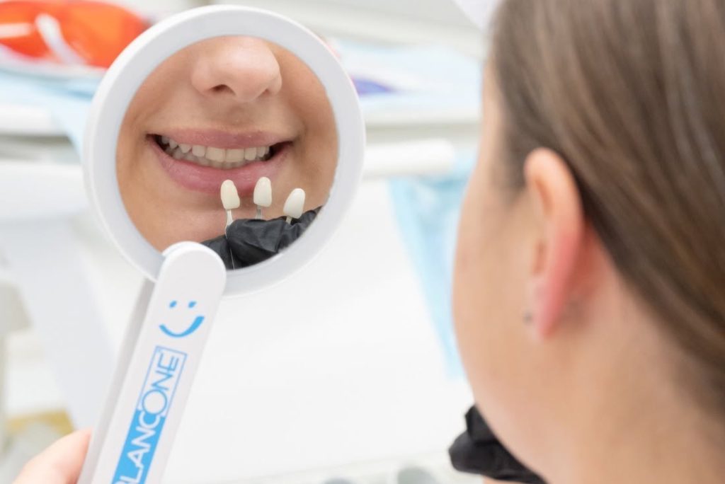 Implantologie & Dinți Ficși smile by dr ilia jipa