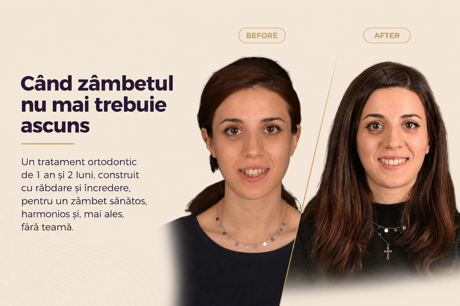 Caz 5: Povestea Dianei www.smilebydrilia.ro 3792