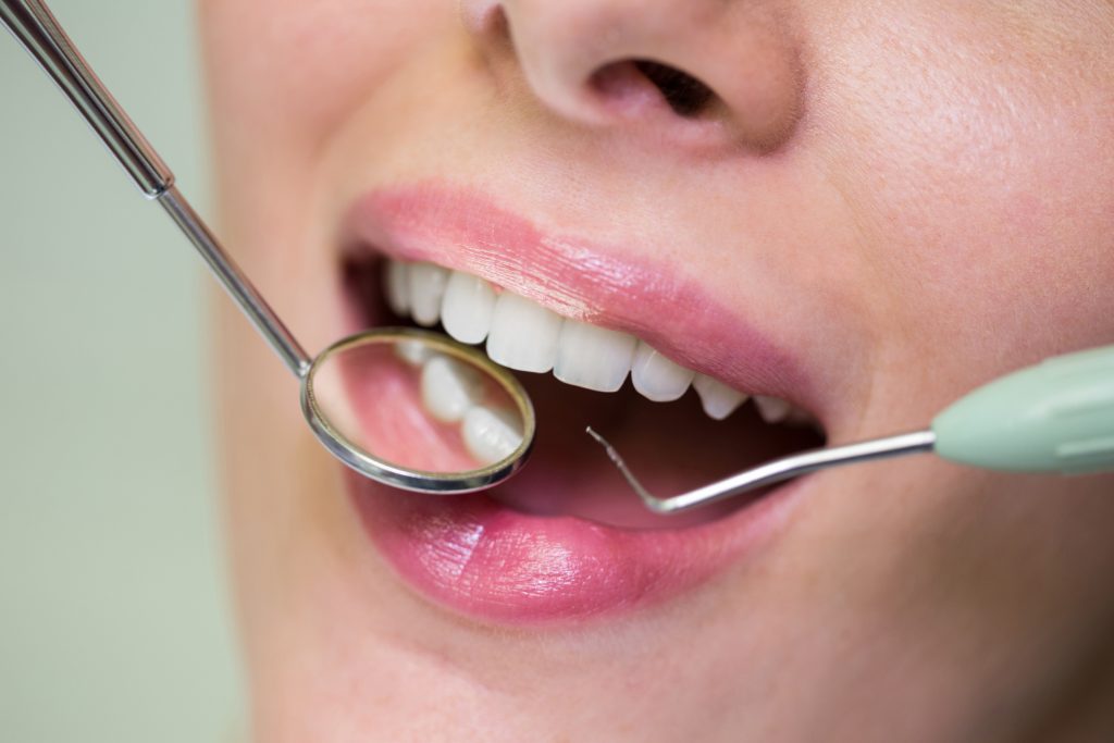 Gingivită sau parodontoză? Cum faci diferența? www.smilebydrilia.ro 2933