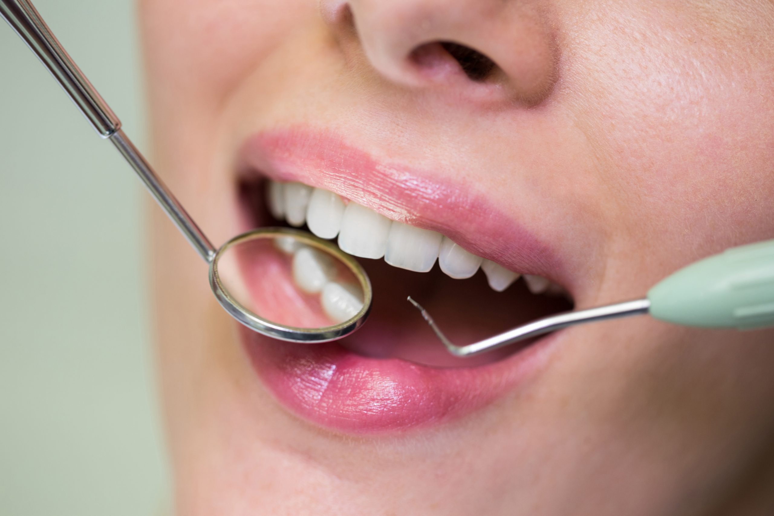 Gingivită sau parodontoză? Cum faci diferența? www.smilebydrilia.ro 2933