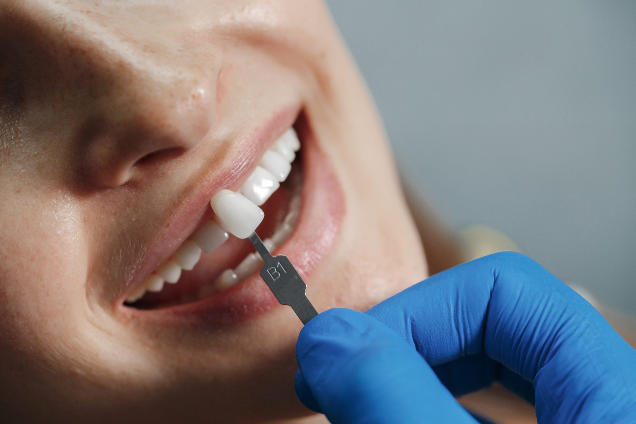 Gingivită sau parodontoză? Cum faci diferența? www.smilebydrilia.ro 2925