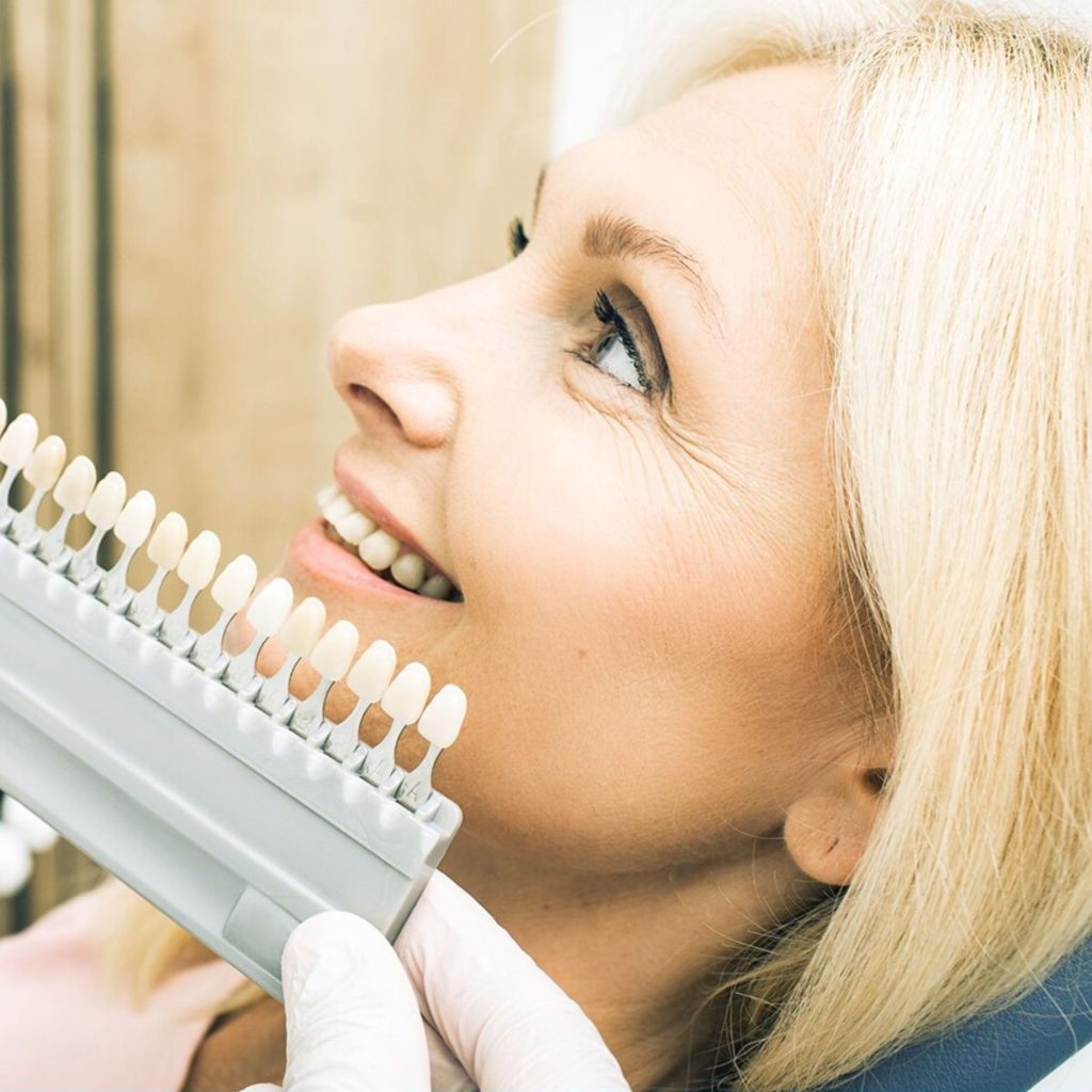 Estetică Dentară www.smilebydrilia.ro 3515