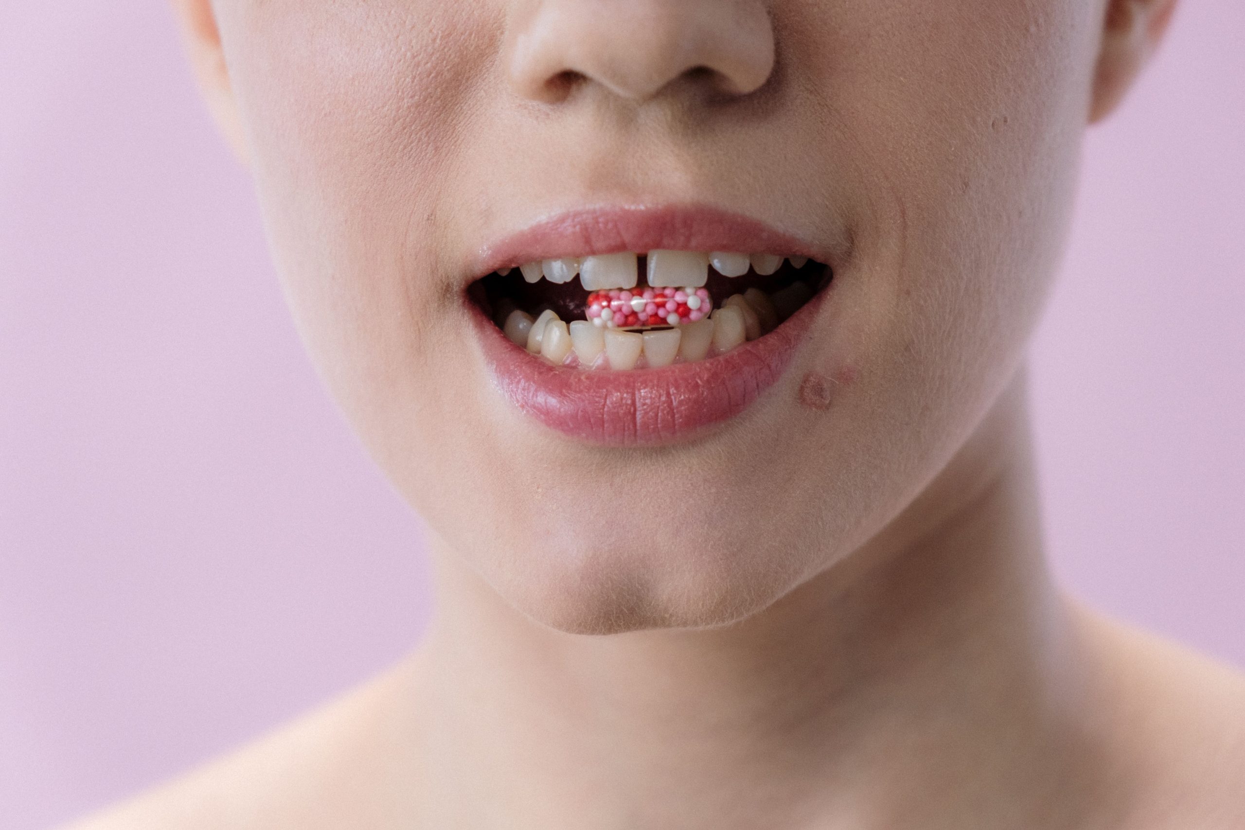 Am spații între dinți. Ce opțiuni am? Ghid complet despre diastemă și spațiile dentare www.smilebydrilia.ro 3009