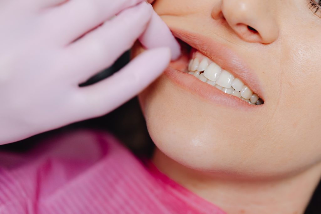 Parodontoza. Tot ce trebuie să știi despre boala care poate duce la pierderea dinților www.smilebydrilia.ro 2892