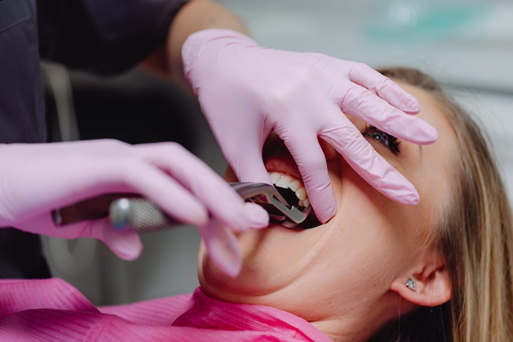 Mă doare după tratamentul de canal? Ce este normal? www.smilebydrilia.ro 2965