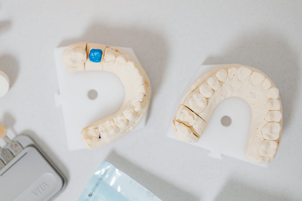 De ce trebuie pusă o coroană după tratamentul de canal? www.smilebydrilia.ro 2967