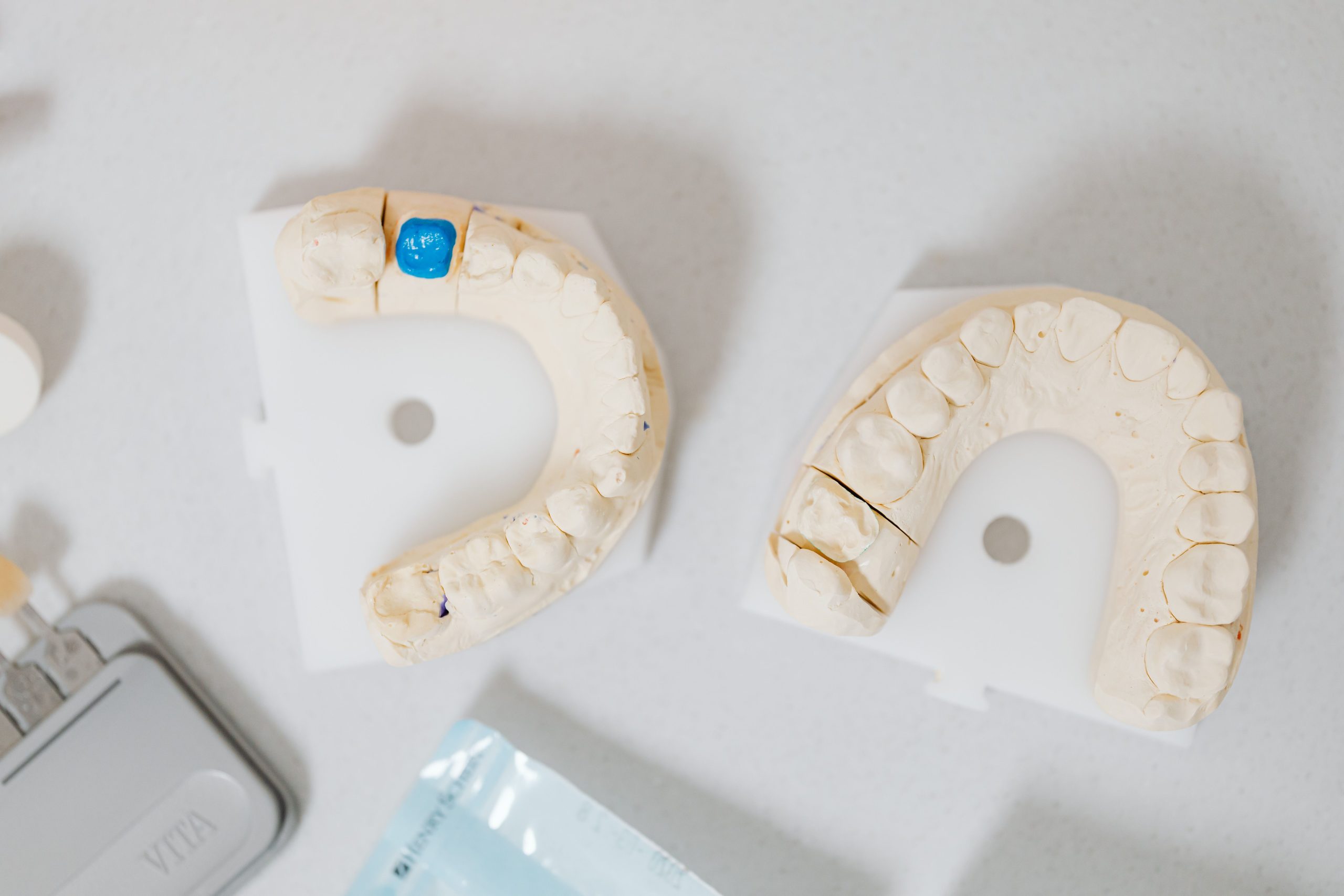 De ce trebuie pusă o coroană după tratamentul de canal? www.smilebydrilia.ro 2967