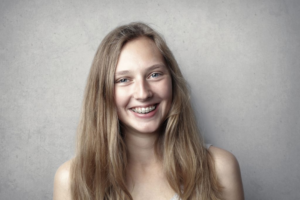 Am spații între dinți. Ce opțiuni am? Ghid complet despre diastemă și spațiile dentare www.smilebydrilia.ro 3010